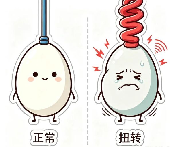 睾丸扭转：一种拖不得的男性急症